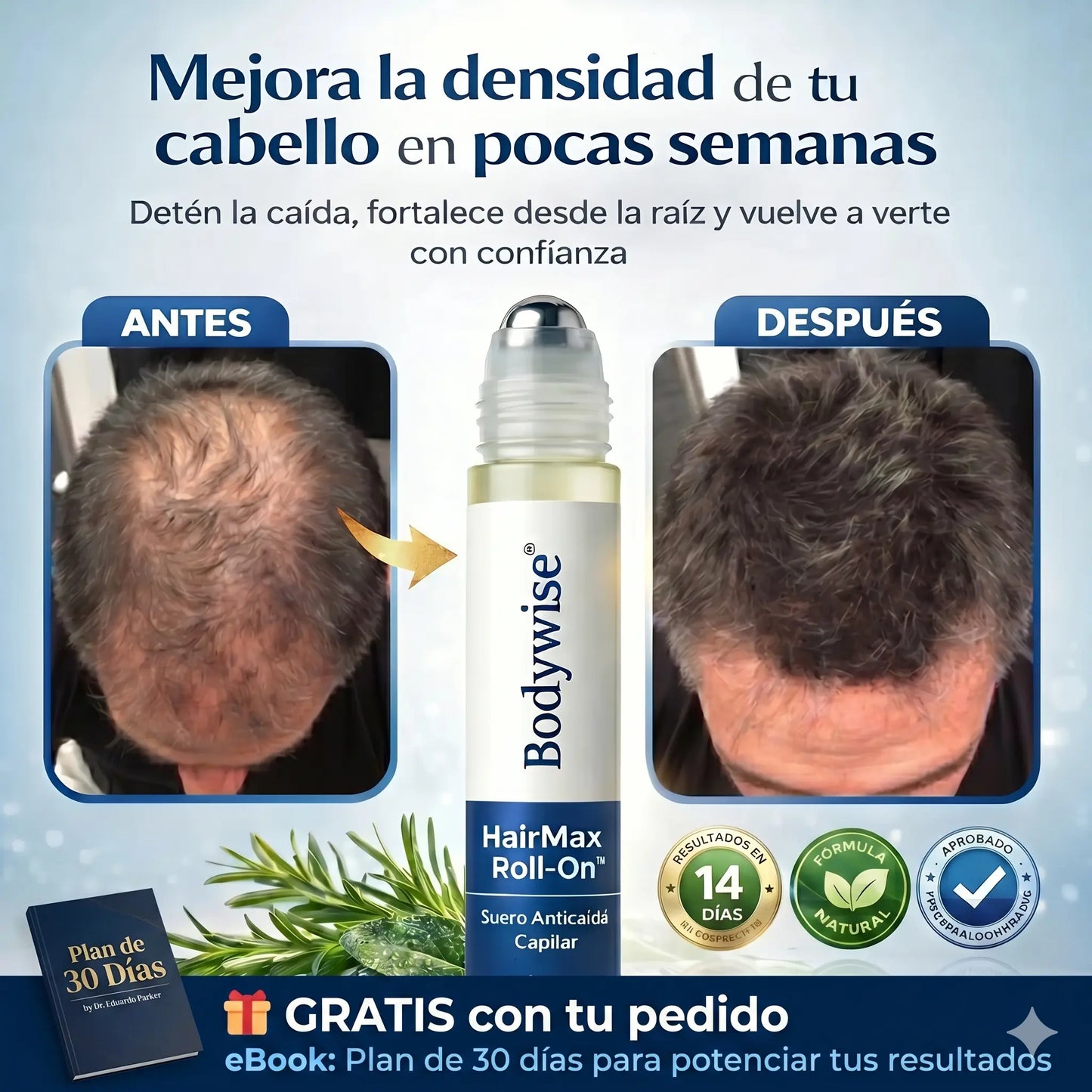HairMax Roll-On™ - Deten la caida y recupera la densidad de tu cabello en semanas
